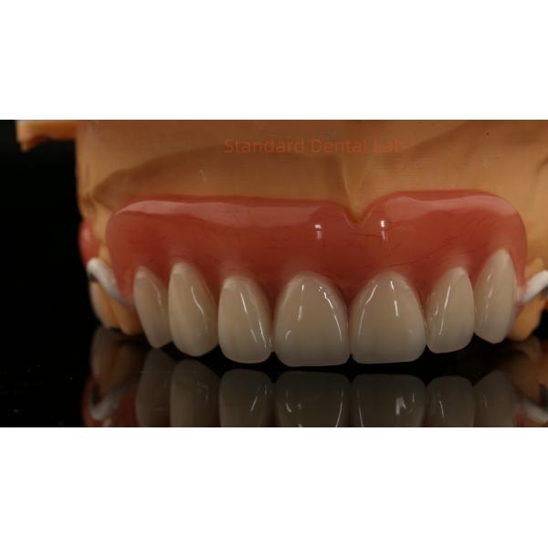 Peek Partial Framework Design ISO CE And FDA Dental Lab Acrylic Partial Denture Framework