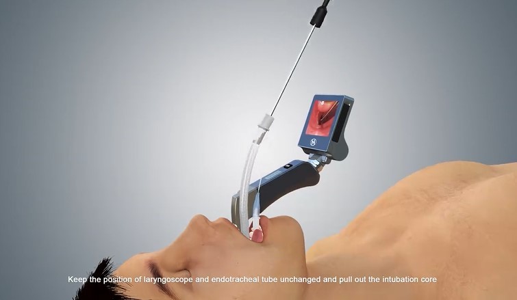 Remarkable Durable Medical Direct Laryngoscope for Difficult Airway Intubation