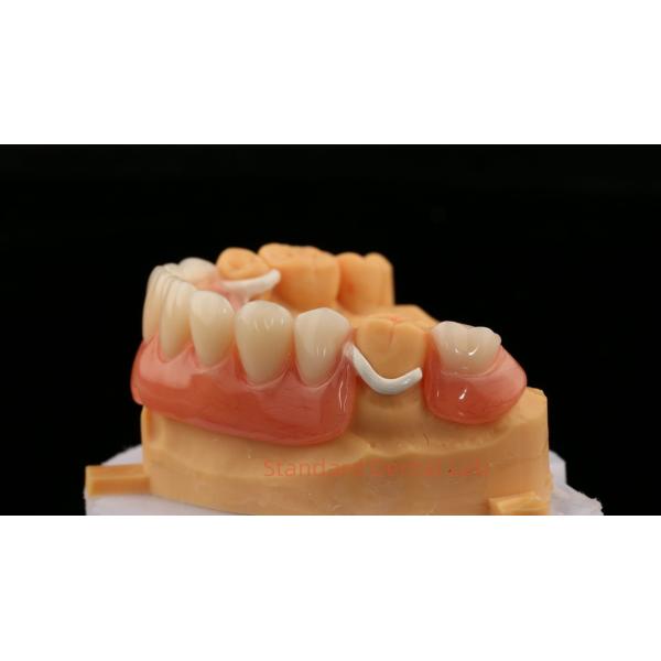 Peek Partial Framework Design ISO CE And FDA Dental Lab Acrylic Partial Denture Framework