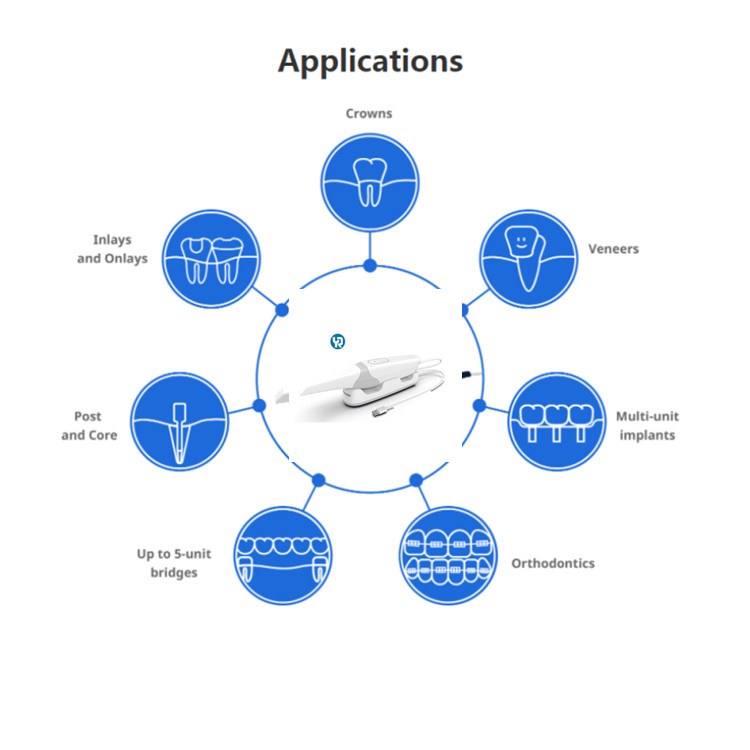 YUCERA 3D Intraoral Scanner Dental with USB 3.0 20μm Accuracy