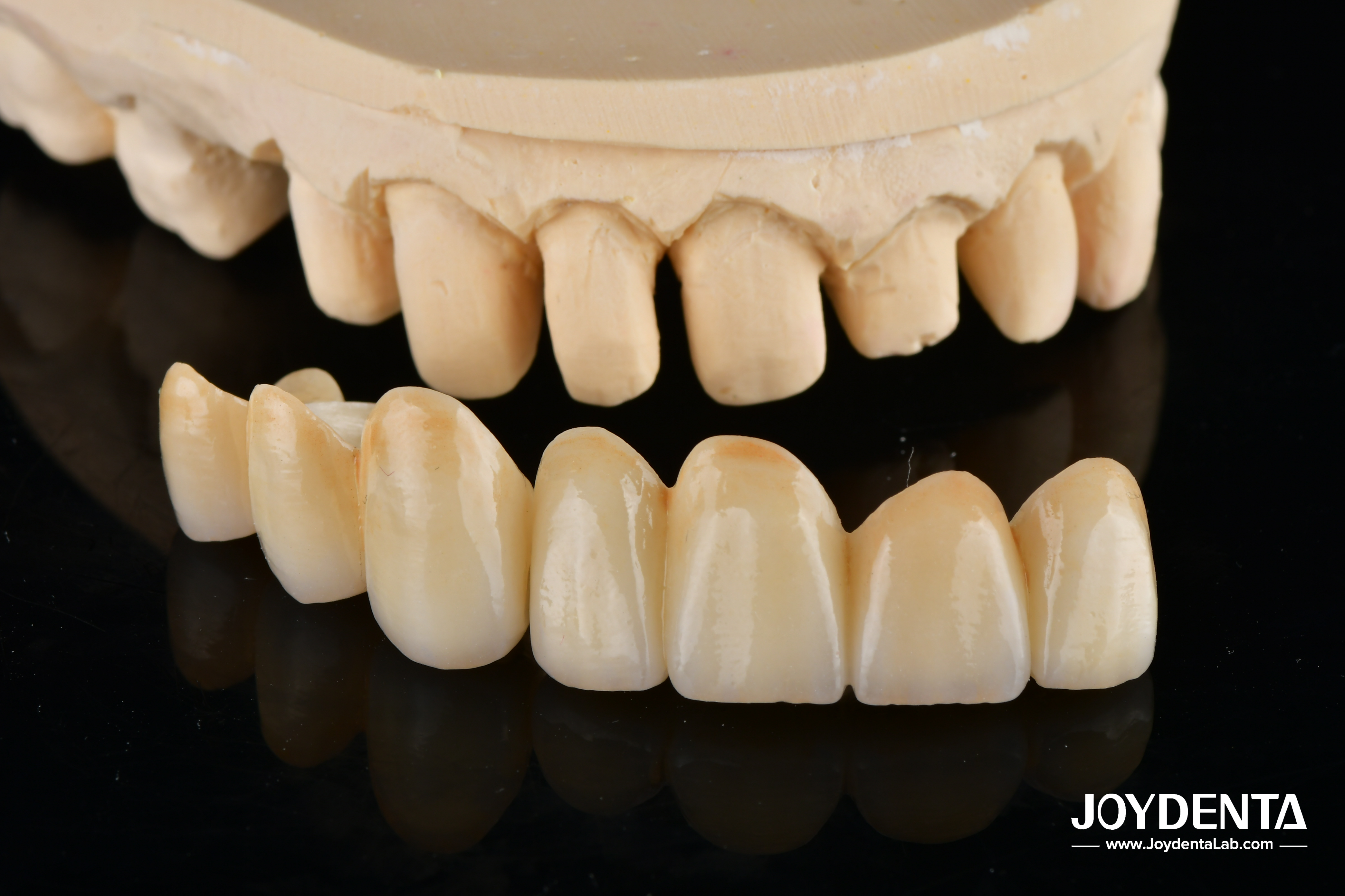 Quality Unveil True Biomimicry: Introducing Our Multi-Layered Zirconia Aesthetic Bridge for sale