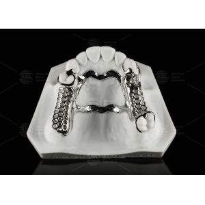 Repairable Cobalt Chromium Dental Metal Framework Partial Denture