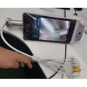 15W AI Face Recognition Infrared Thermometer 1000Mbps Ethernet Bluetooth