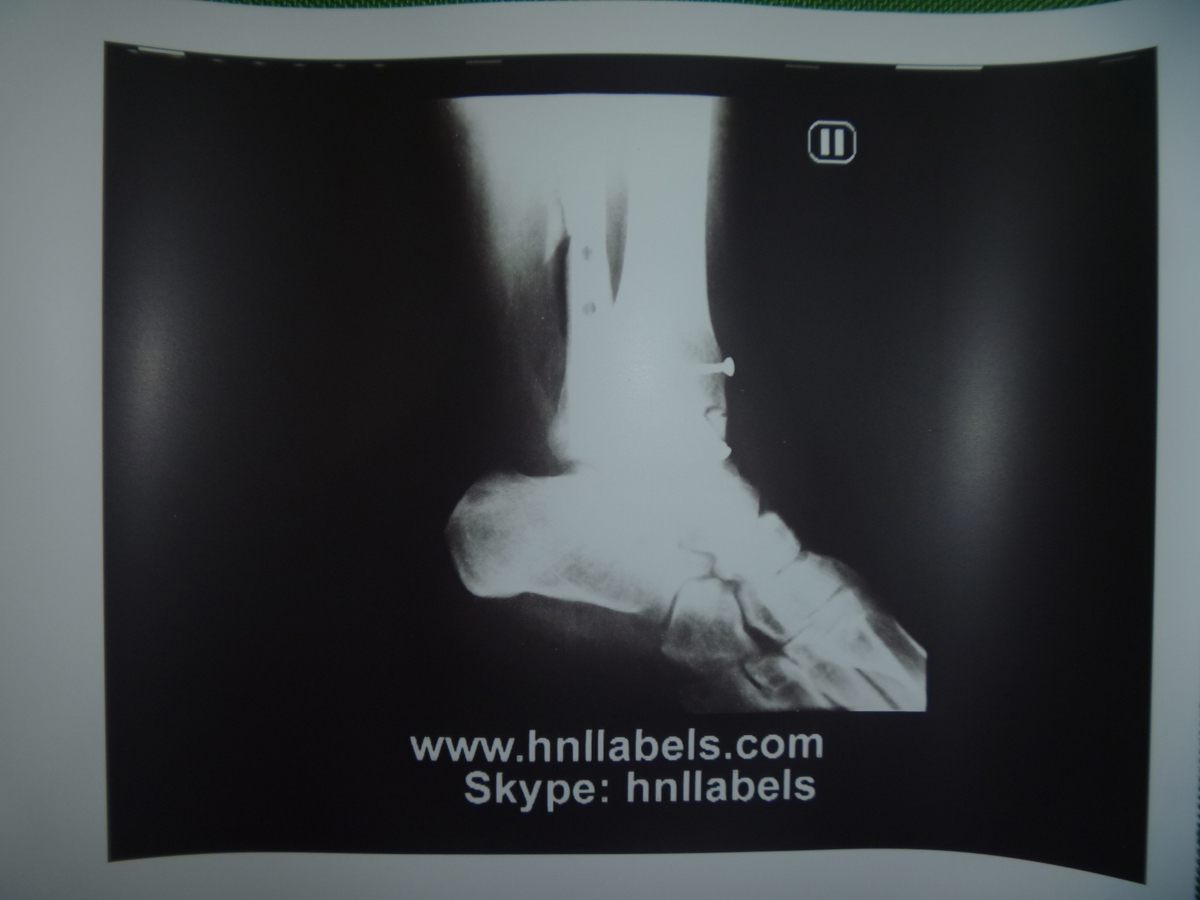 upp-110s,sony ultrasound paper, sony upp-110s