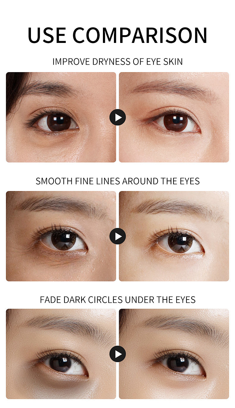 Silicone Free Gold Niacinamide Eye Cream Mask Moisturizing Whitening OEM