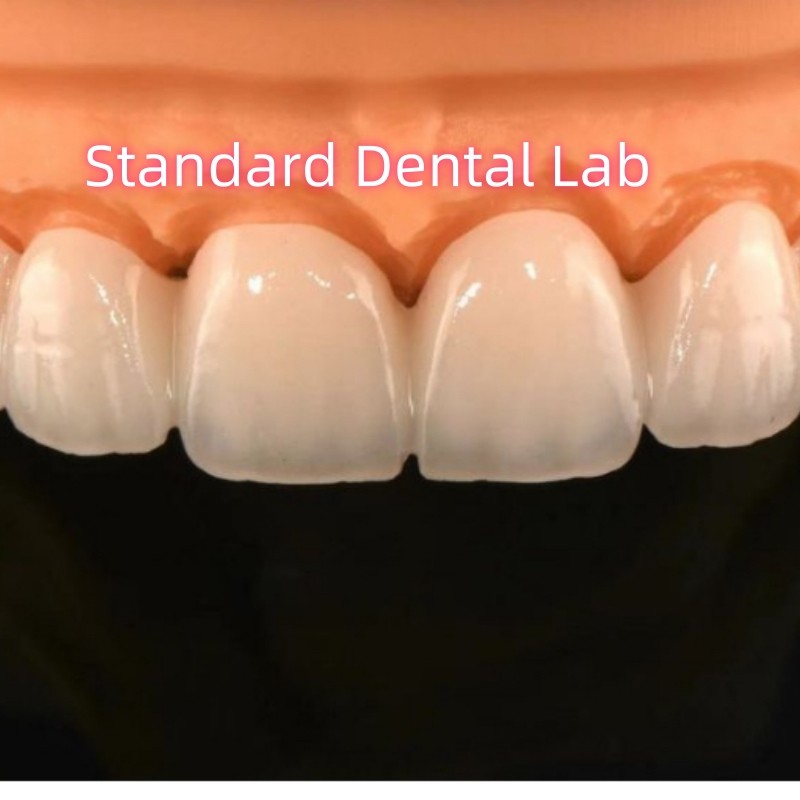 Quality Zirconia Crowns Bridge Dental Lab With Layered Porcelain for sale