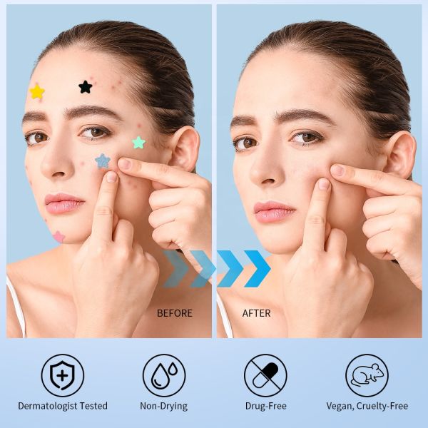Customized Color Hydrocolloid Acne Pimple Patch Star Shape For All Skin Types
