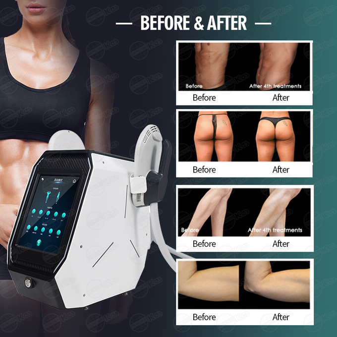 Cutting Edge 2 Handles Ems Body Sculpting Machine Muscle Stimulation Fat Burning For Salon