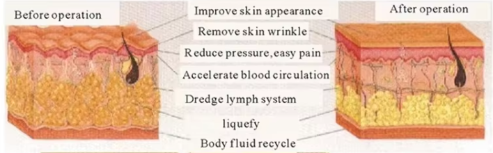 448khz Cet Ret Resistive RF Pain Relief Tecar Therapy Machine