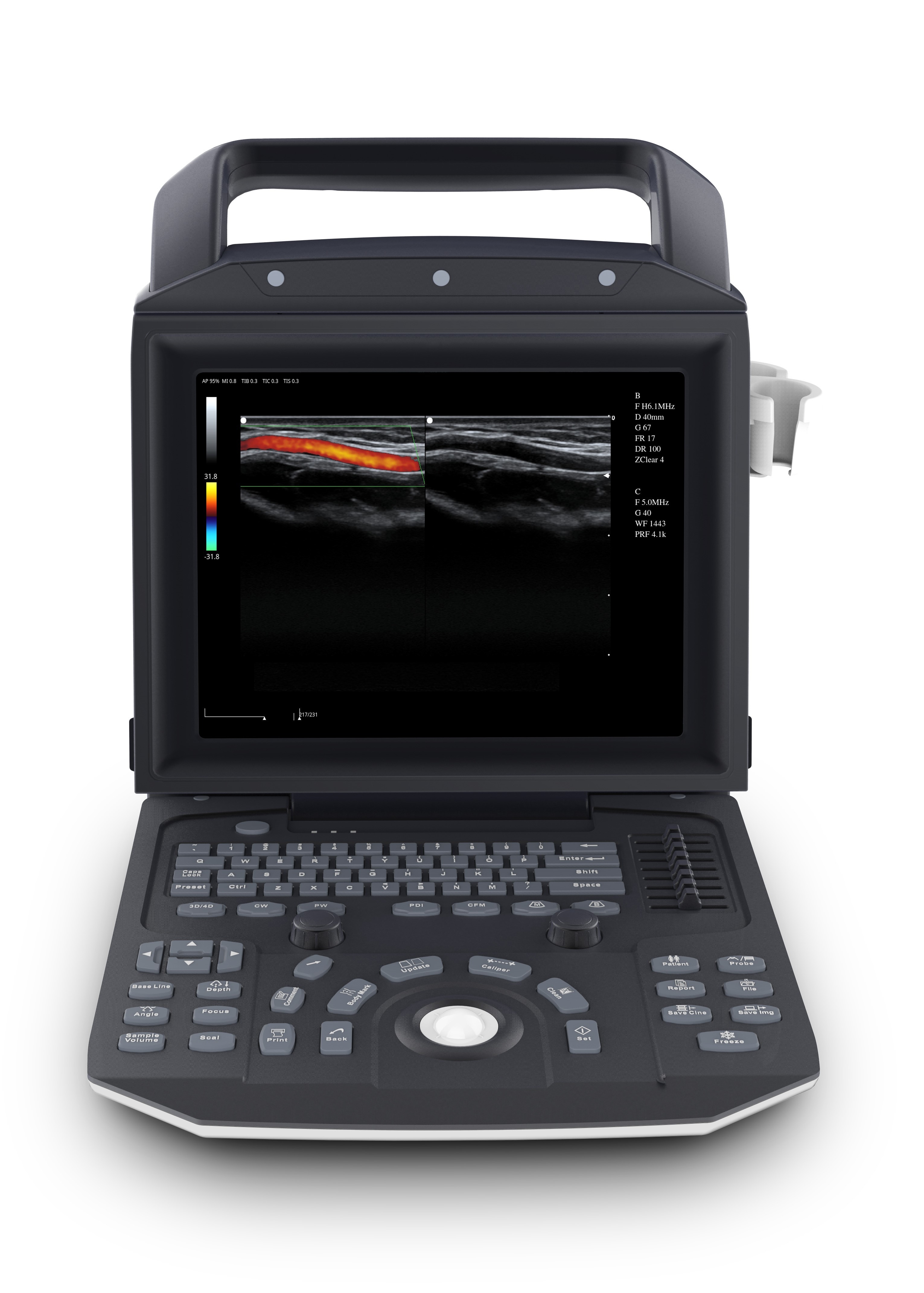 High Resolution Portable Ultrasound Scanner / Ultrasonography Machine 12 Inch 7.45KG 200VA