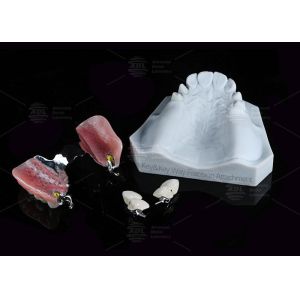 Dental Prostheses Key Way Attachment Precision Attachment Adjustable Retentive