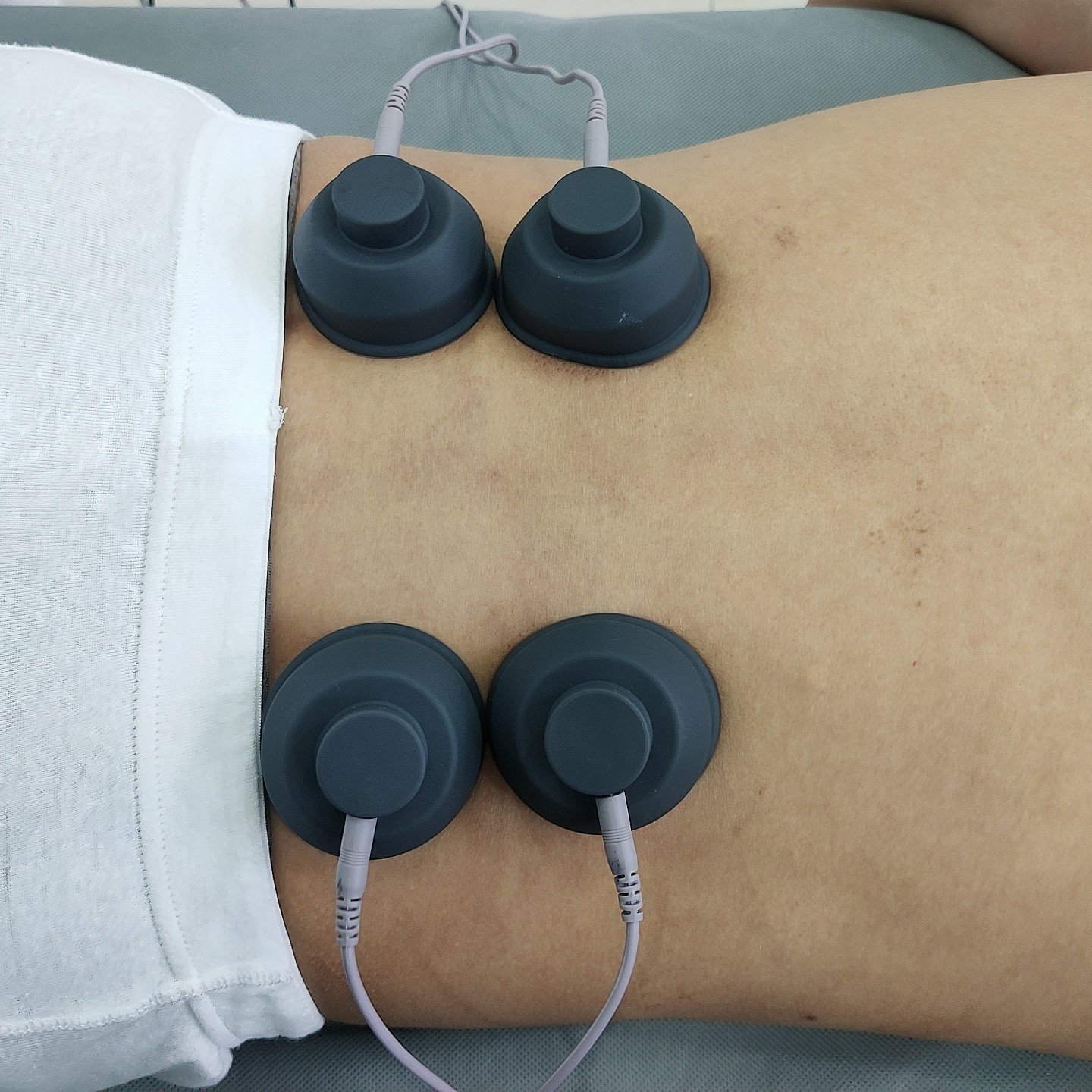 200MJ EMS Slimming Electrical Muscle Stimulation Machine