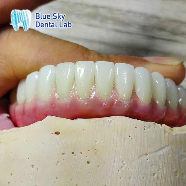 Sterilization Steam Sterilization Implant Cases with Universal Compatibility