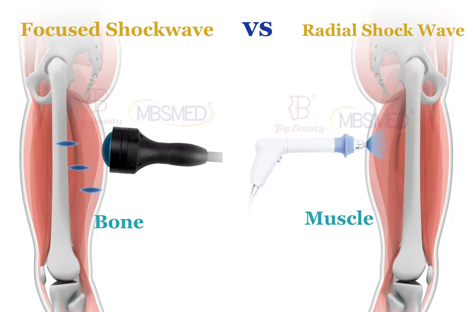 Portable ED Pain Relief Focused Shockwave Therapy Physiotherapy Focused 10bar Shock Wave Machine