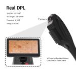 OPT Technology Hair Removal Machine Power 3500W With DPL Function