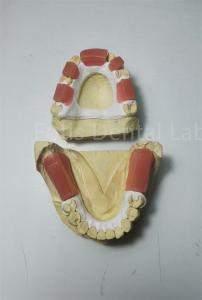 Quality Dental Wax Bite Rims Glossy Red Finish Unique Occluding Relation for sale