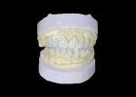 Precision Crafted IPS e.max Veneers for Unrivaled Smile Transformations