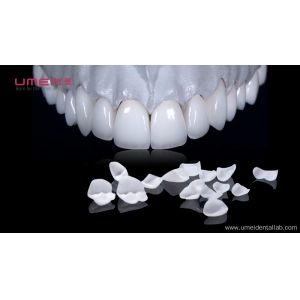 China Hollywood White Veneers on sale