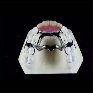 Co Cr Biocompatibile Metal Cast Framework Partial Dentures ODM