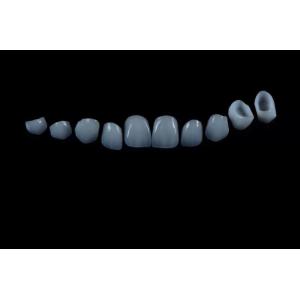 Quality Cosmetic Digital Porcelain Emax Laminate Veneers Customizable for sale