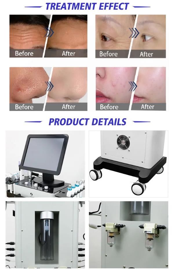 12" Touch Screen Hydradermabrasion Machine With Skin Scrubber Handpiece