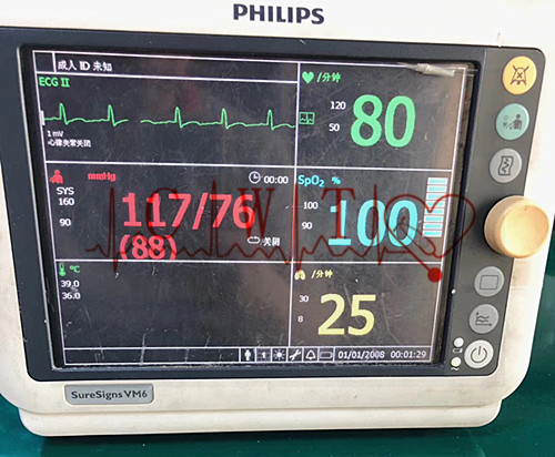 Quality Refurbished Hospital Patient Monitor for sale