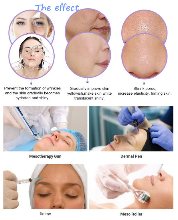 Meso Serum Hyaluronic Acid Mesotherapy Solutions For Skin Care 5ml / Vial