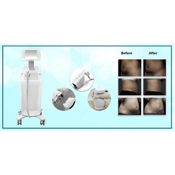 new arrival liposonix weight loss machine