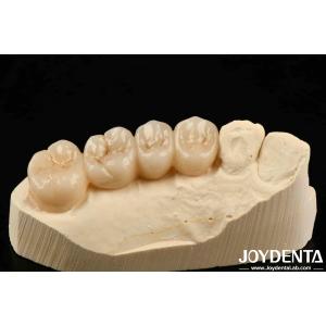Multilayer Full Zirconia White Style With Layers High Translucency High