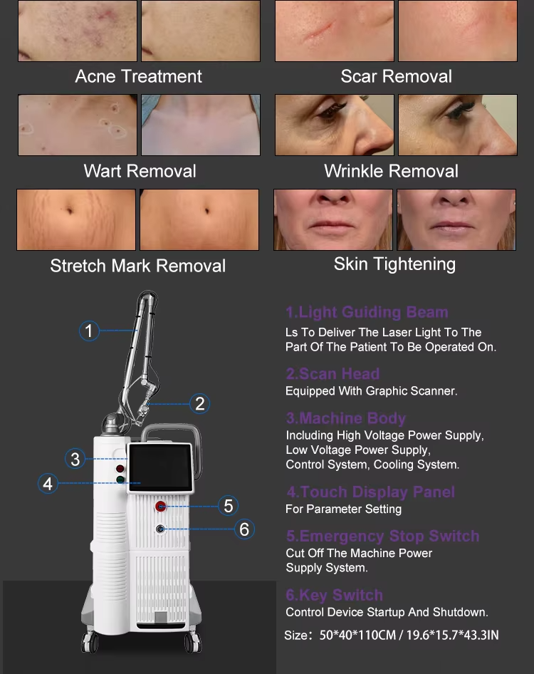 60W Ractional Co2 Laser Beauty Machine 220V Fractional Laser Resurfacing Machine Stationary