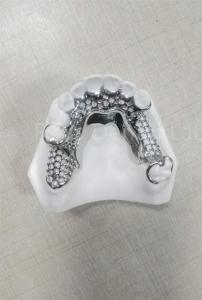 Quality High Stability Flexible Partial Dentures Easy Cleaning Regular Maintenance for sale