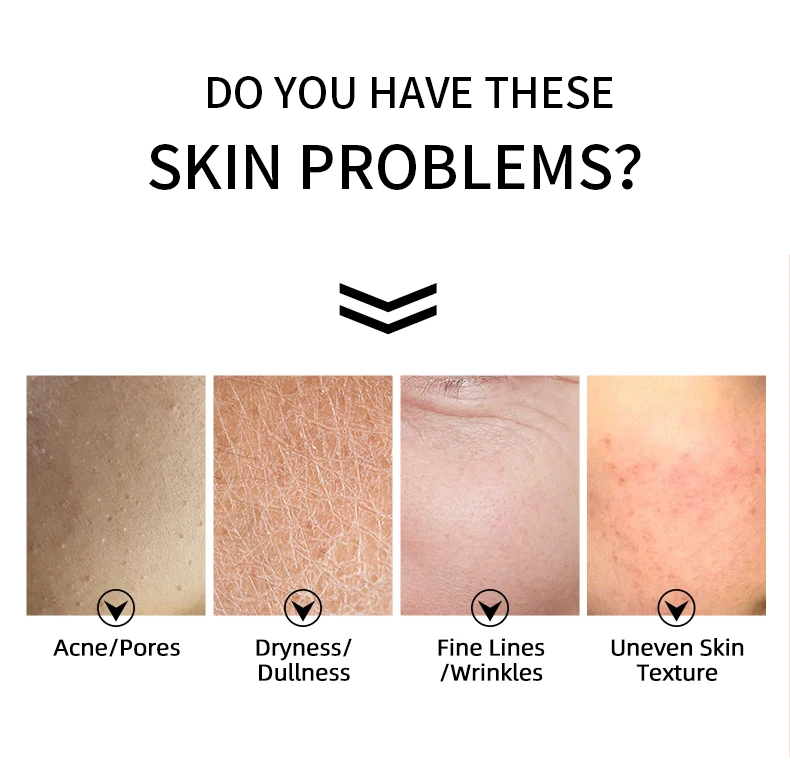 Custom Sensitive Combination Skin Products Pores Cleanser Cosmeceuticals Products