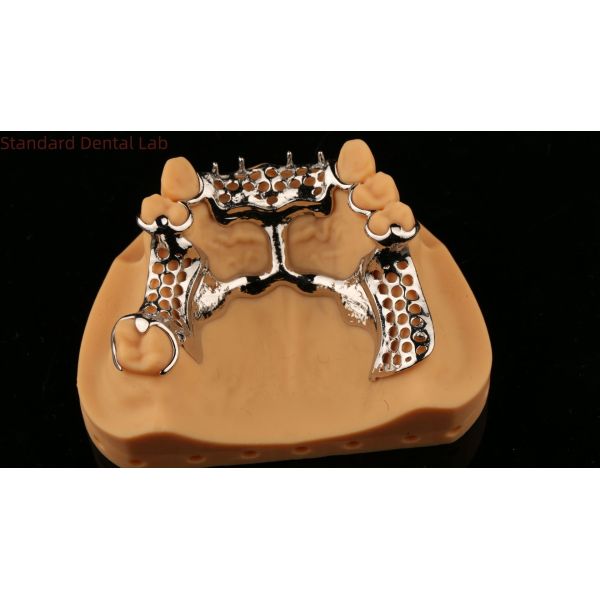 Upper Cast Framework Acrylic Metal Partial Dentures Strong Lightweight and Durable